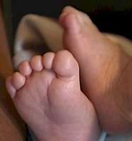 A baby born in Florida 2009 with six toes and fingers