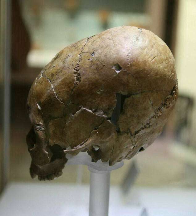 elongated skull from Antakya