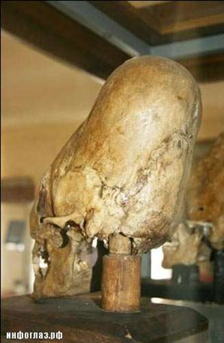 elongated skull of Stavrapol
