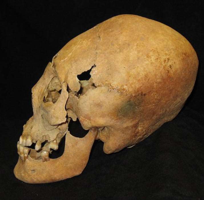 Another elongated skull. This one is slanted backwards.
