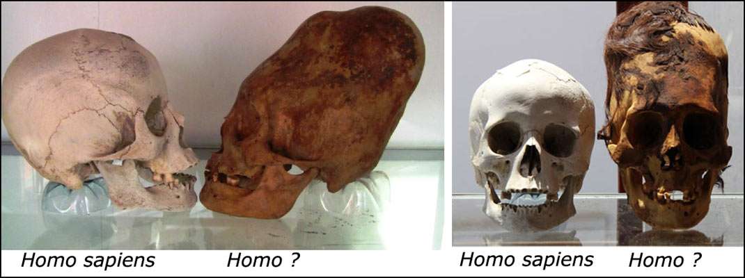 comparison of elongated skulls with normal human skulls