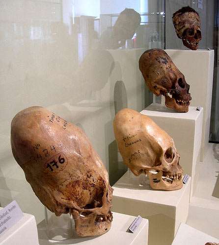 elongated skull on display in a museum