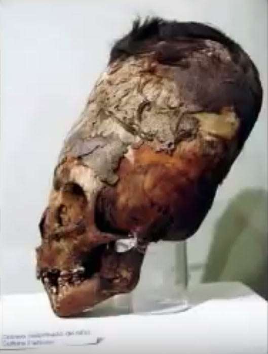 elongated skull from Paracas