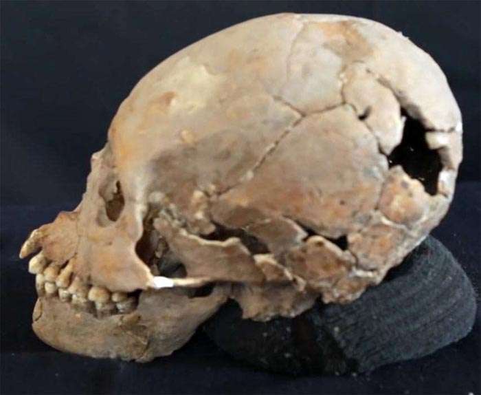 Teotihuacan skull