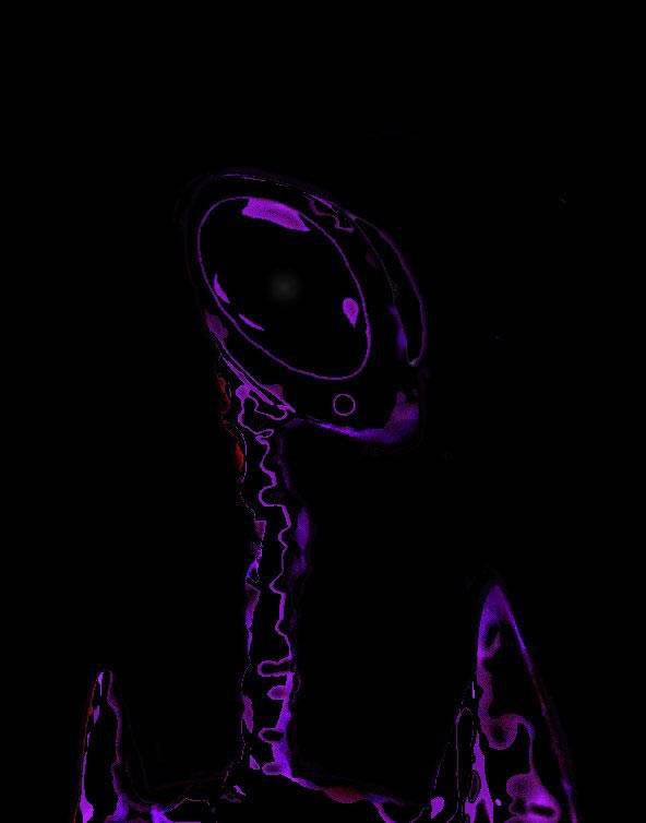 Artwork by Jim G. of Mantis type alien. On this occasion, Jim noticed a small hole just below the eye as depicted above. (UFO BC) 